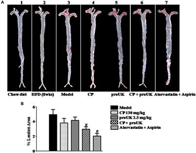 Cardiotonic Pills Plus Recombinant Human Prourokinase Ameliorates Atherosclerotic Lesions in LDLR–/– Mice